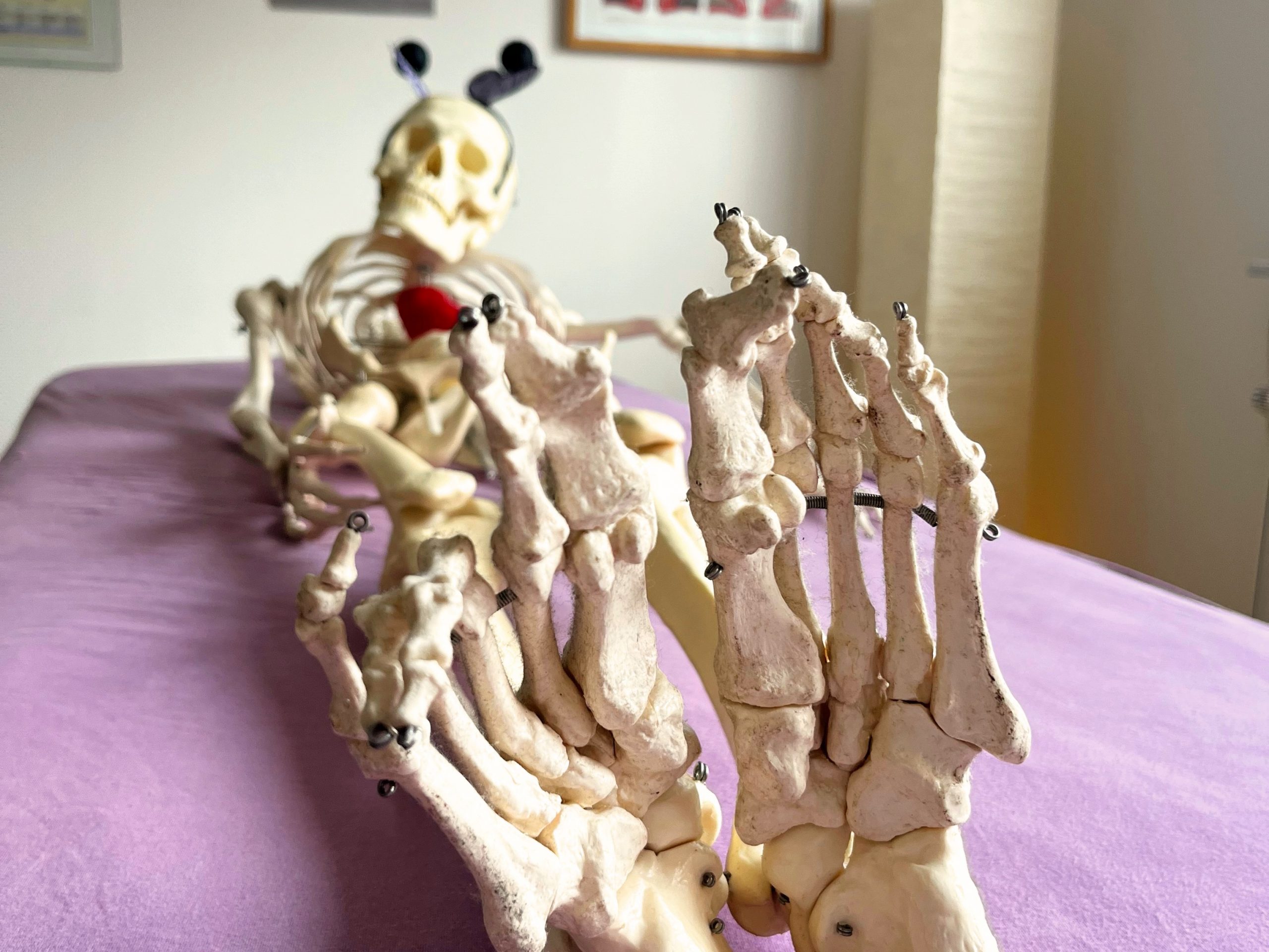 Beinlängendifferenz_4zu3_bear